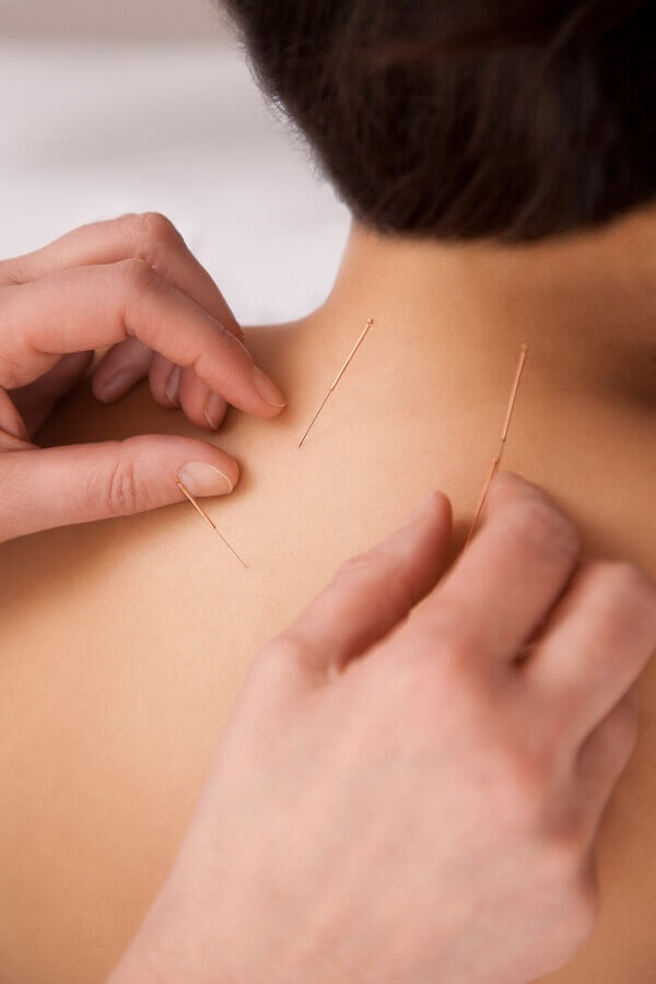 Acupuncturist what you need to know if a complaint is filed with the texas state board of acupuncture examiners 1