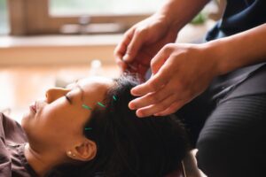 How a texas acupuncturist can defend their license